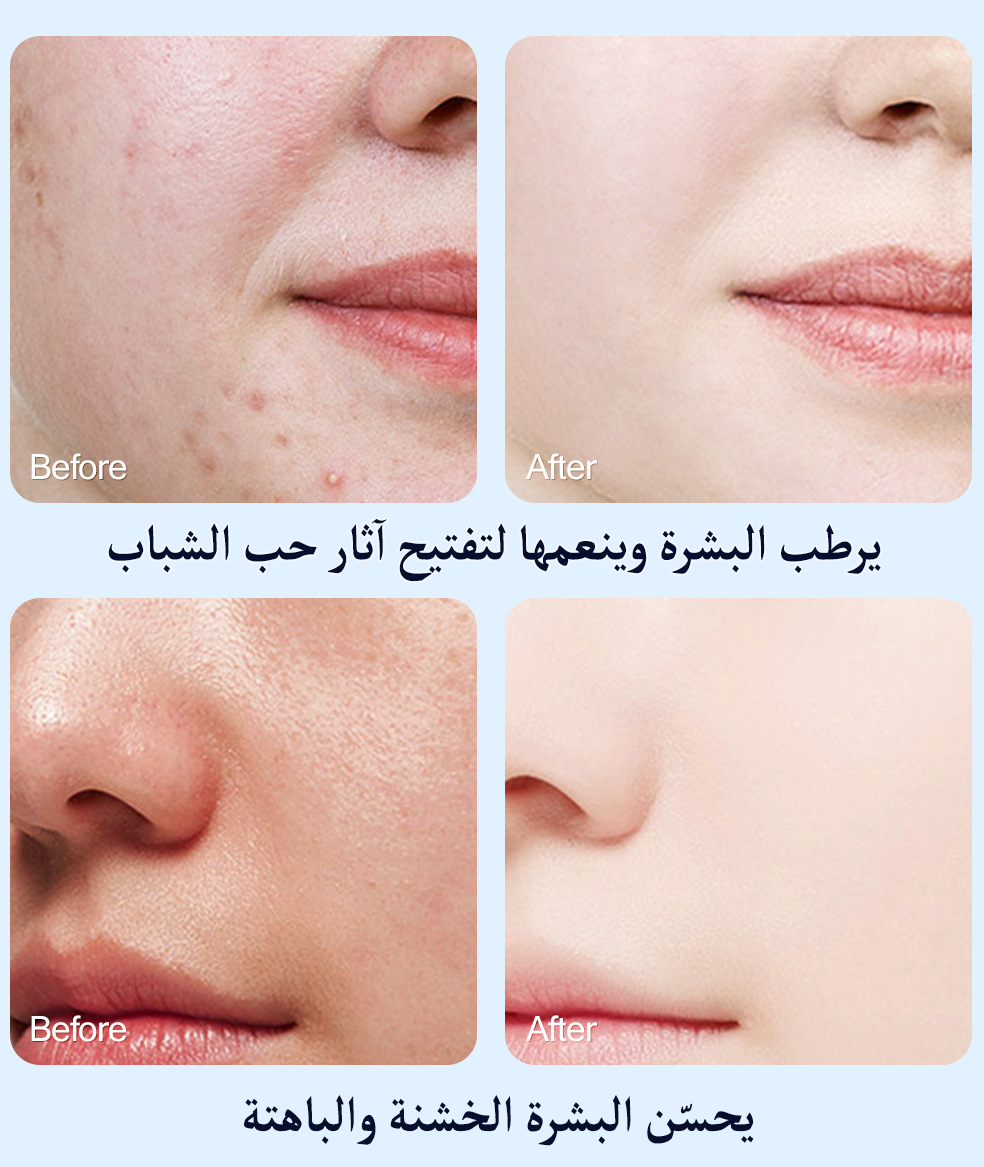 الغسول الكوري لتنظيف و علاج البشرة الدهنية ΜΟΟΥAΜ